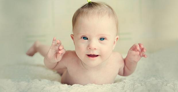 La prueba médica que puede llevar a que no nazcan más bebés con síndrome de Down-0
